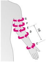 Как подобрать размер РНК бандажа medi